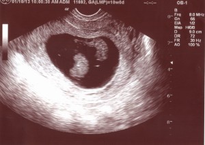 ecografias en el embarazo